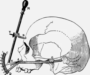 Goniometer and Skull Vector