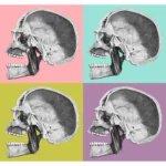Human Skull Side with Cross Section
